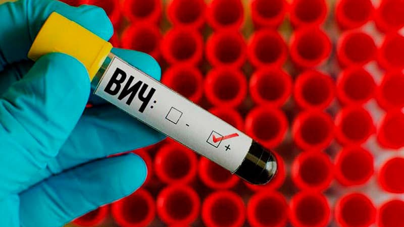 Как проходят похороны ВИЧ-инфицированных?